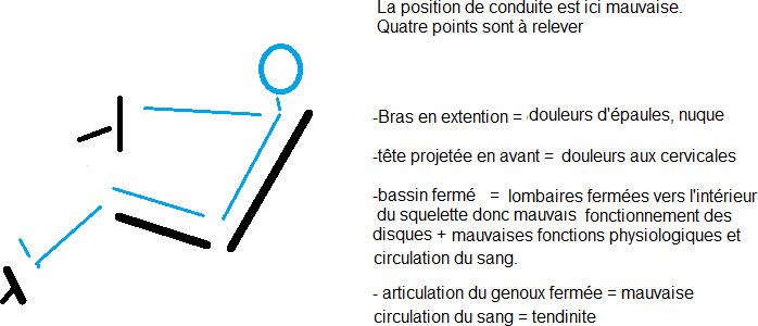 Mauvaise posture de conduite Mauvaise posture de conduite