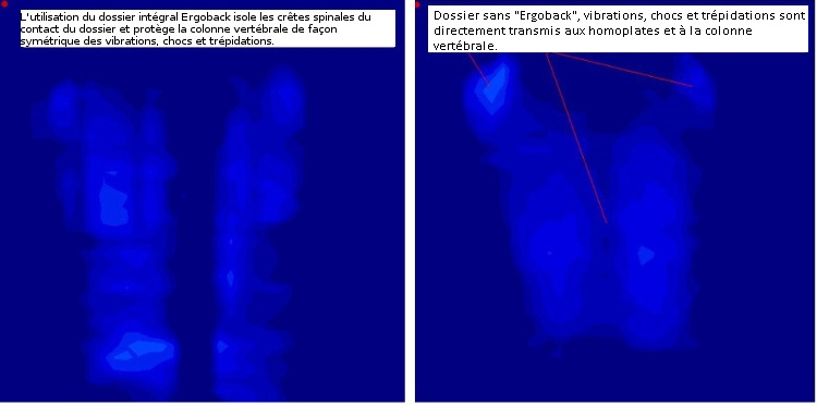 Points de contacts avec le siege équipé ou non de l'Ergoback intégrale