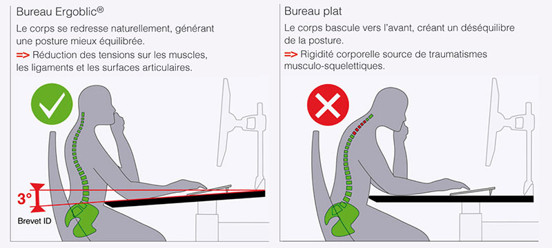 Détail de la posture avec ERGOBLIC bureau ergonomique